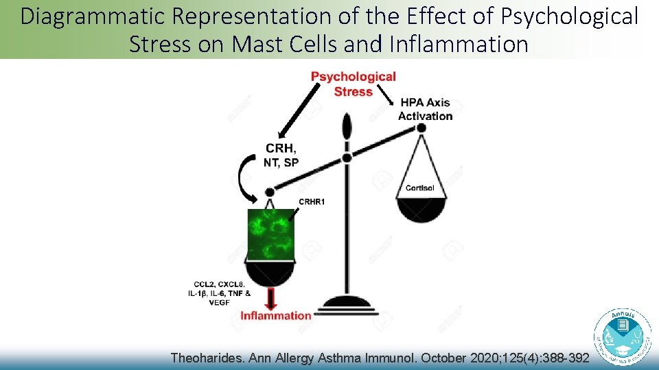 Diagrammatic Representation of the Effect of Psychological Stress on Mast Cells and Inflammation Theoharides. Diagrammatic Representation of the Effect of Psychological Stress on Mast Cells and Inflammation Theoharides.