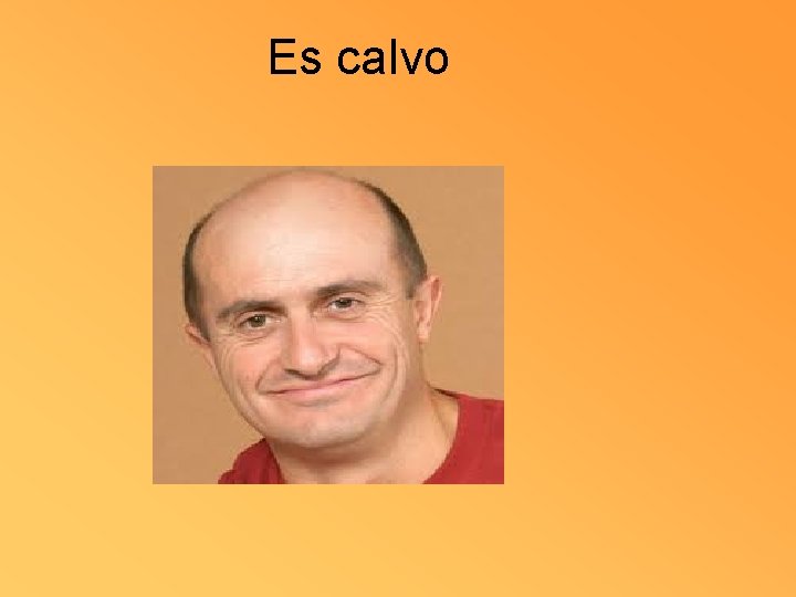 Es calvo 