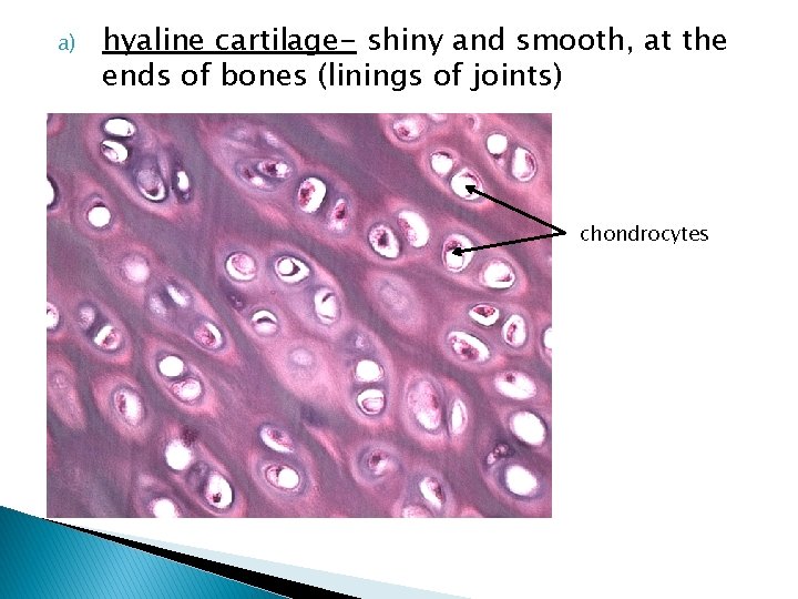 a) hyaline cartilage- shiny and smooth, at the ends of bones (linings of joints)