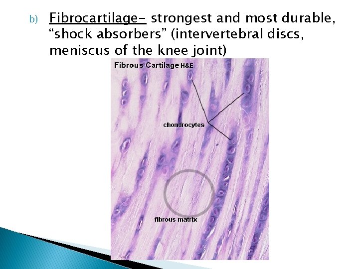 b) Fibrocartilage- strongest and most durable, “shock absorbers” (intervertebral discs, meniscus of the knee