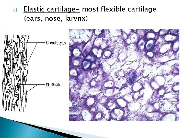 c) Elastic cartilage- most flexible cartilage (ears, nose, larynx) 