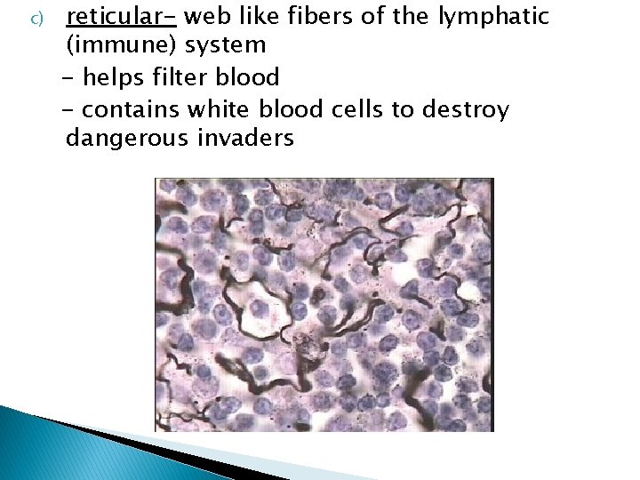 c) reticular- web like fibers of the lymphatic (immune) system - helps filter blood