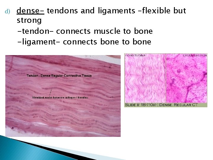 d) dense- tendons and ligaments –flexible but strong -tendon- connects muscle to bone -ligament-