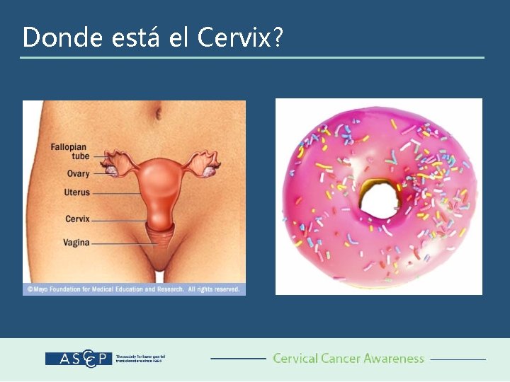 Donde está el Cervix? 