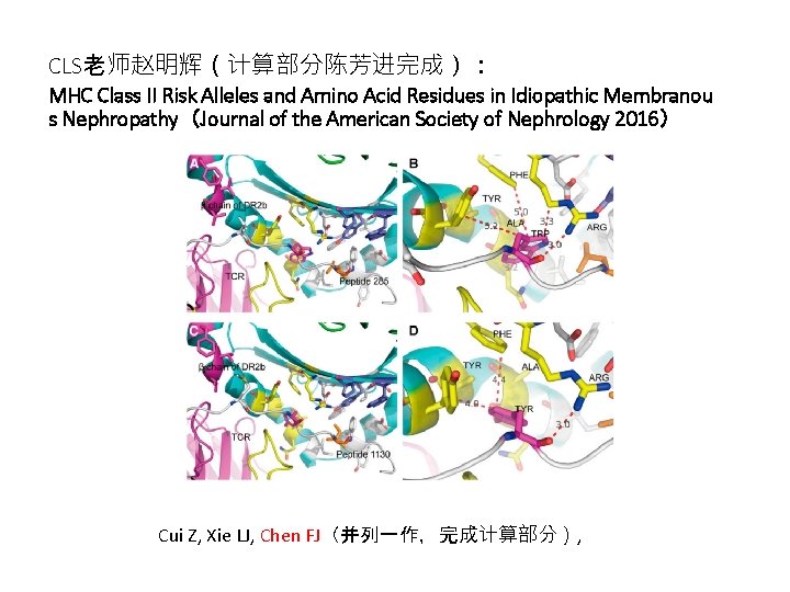  CLS老师赵明辉（计算部分陈芳进完成）： MHC Class II Risk Alleles and Amino Acid Residues in Idiopathic Membranou