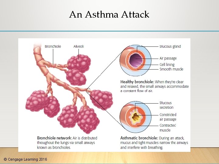 An Asthma Attack © Cengage Learning 2016 