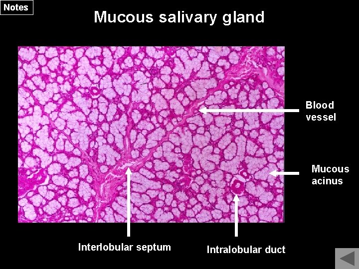 Notes Mucous salivary gland Blood vessel Mucous acinus Interlobular septum Intralobular duct 