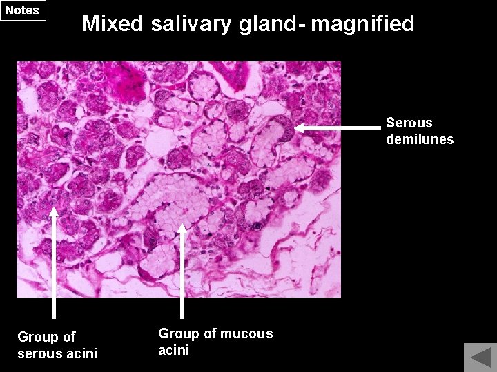 Notes Mixed salivary gland- magnified Serous demilunes Group of serous acini Group of mucous