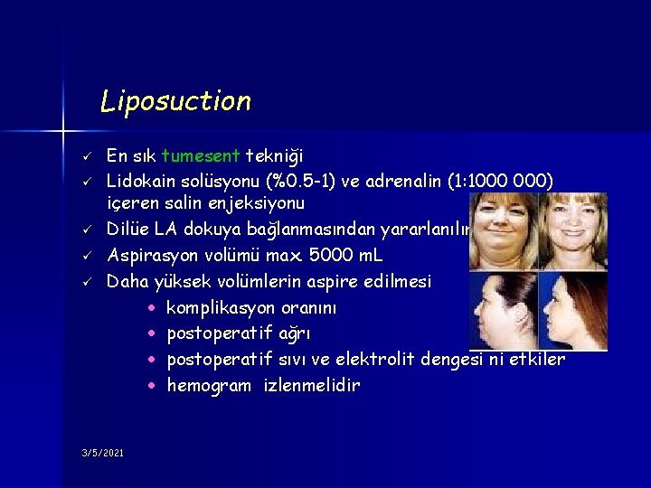 Liposuction ü ü ü En sık tumesent tekniği Lidokain solüsyonu (%0. 5 -1) ve