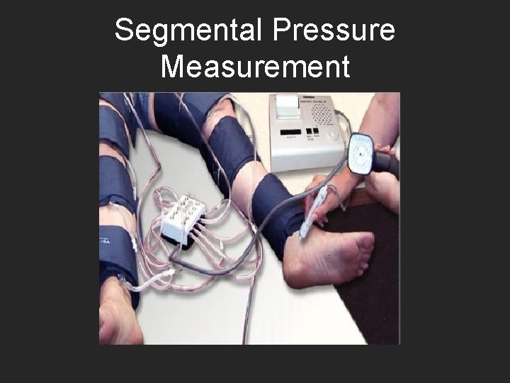 Segmental Pressure Measurement 