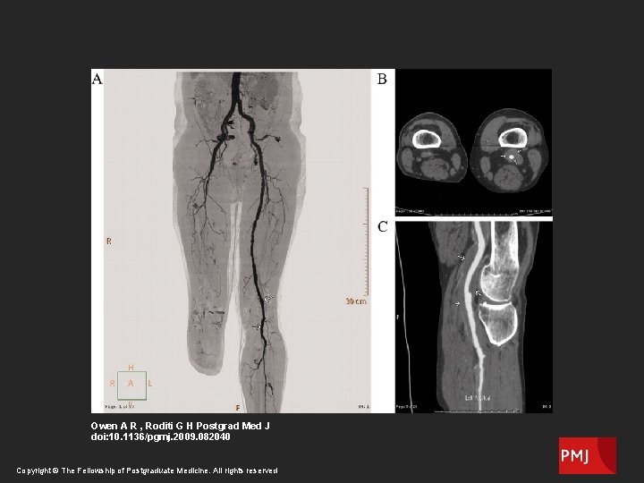 Owen A R , Roditi G H Postgrad Med J doi: 10. 1136/pgmj. 2009. Owen A R , Roditi G H Postgrad Med J doi: 10. 1136/pgmj. 2009.
