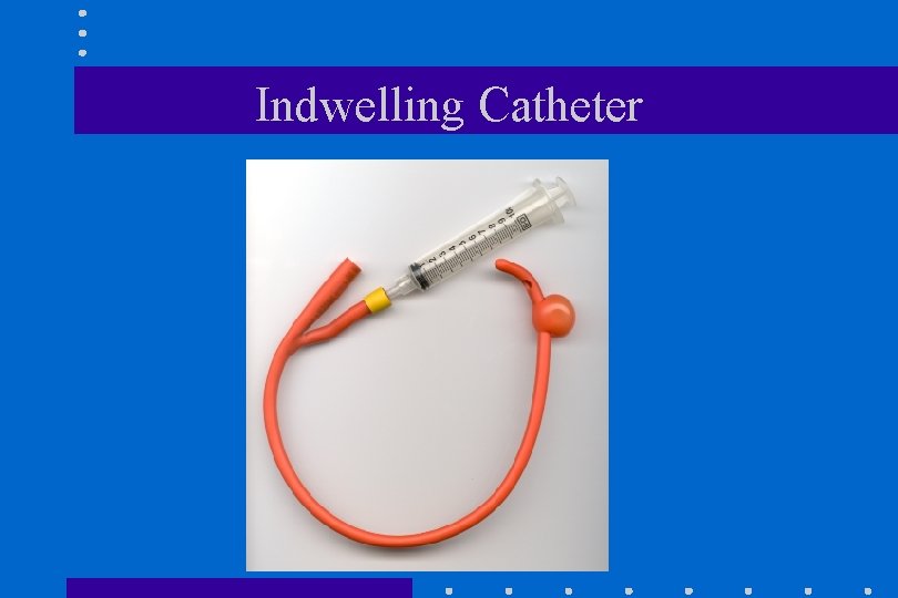 Indwelling Catheter 