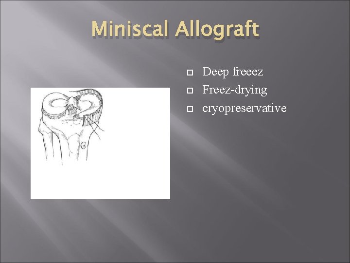 Miniscal Allograft Deep freeez Freez-drying cryopreservative 