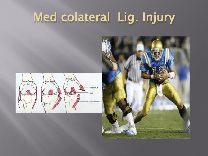 Med colateral Lig. Injury 