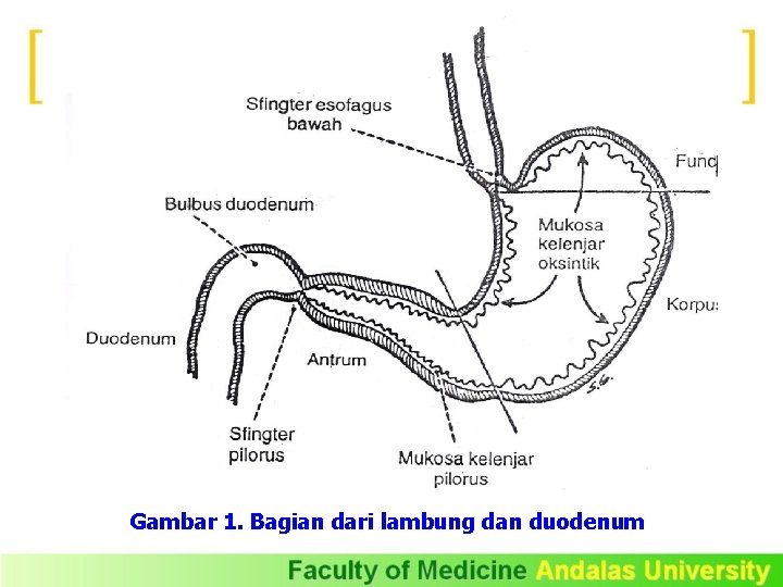 Gambar 1. Bagian dari lambung dan duodenum 