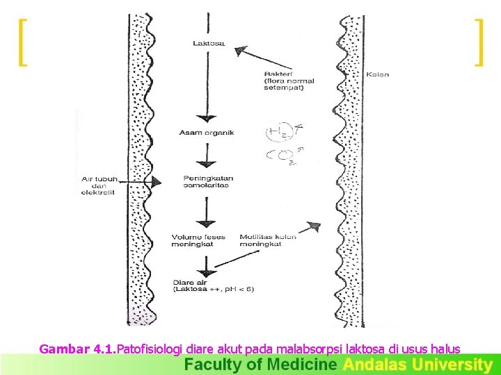 Gambar 4. 1. Patofisiologi diare akut pada malabsorpsi laktosa di usus halus 