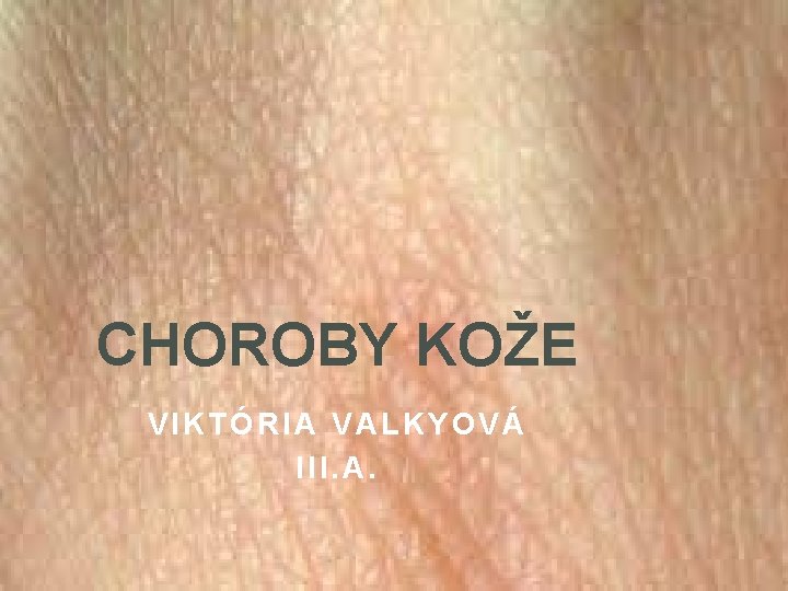 CHOROBY KOŽE VIKTÓRIA VALKYOVÁ III. A. 