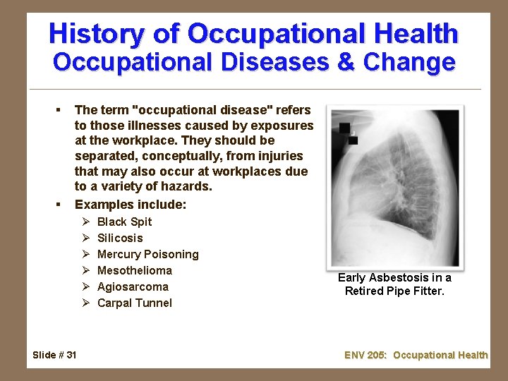 History of Occupational Health Occupational Diseases & Change § § The term "occupational disease"