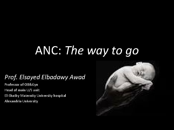 ANC: The way to go Prof. Elsayed Elbadawy Awad Professor of OB&Gyn Head of