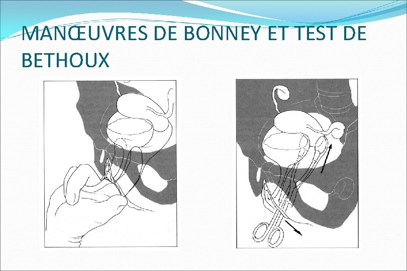 MANŒUVRES DE BONNEY ET TEST DE BETHOUX 