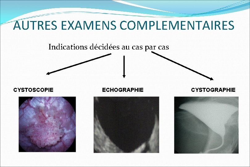 AUTRES EXAMENS COMPLEMENTAIRES Indications décidées au cas par cas CYSTOSCOPIE ECHOGRAPHIE CYSTOGRAPHIE 