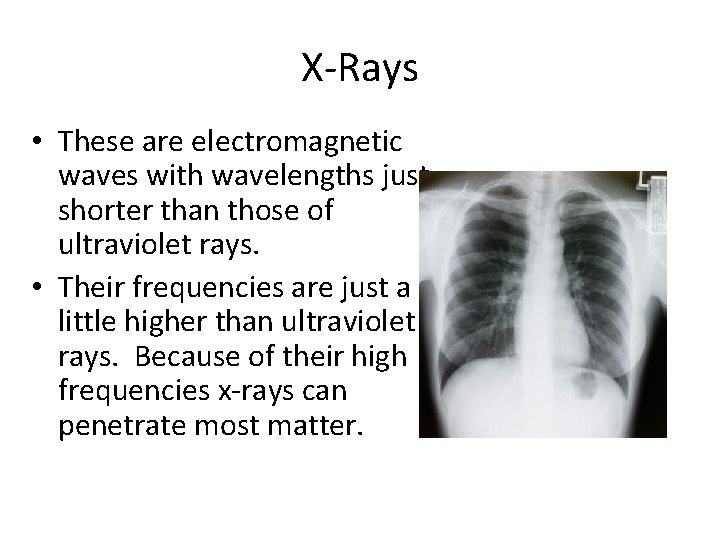 X-Rays • These are electromagnetic waves with wavelengths just shorter than those of ultraviolet