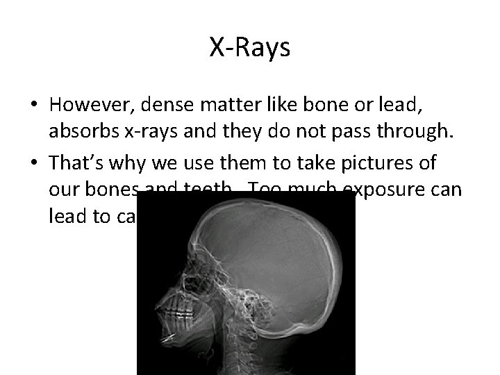 X-Rays • However, dense matter like bone or lead, absorbs x-rays and they do