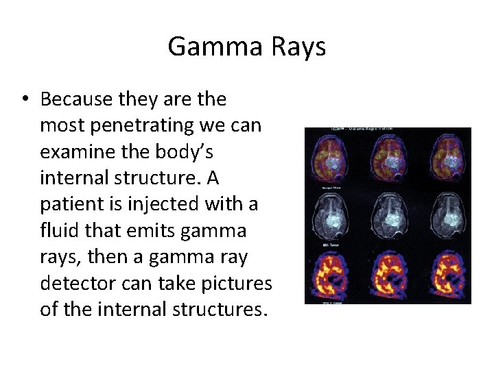 Gamma Rays • Because they are the most penetrating we can examine the body’s
