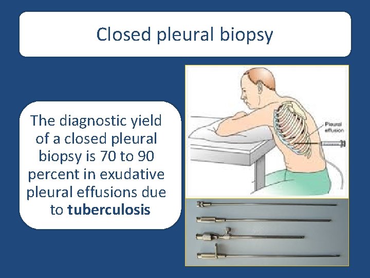 Closed pleural biopsy The diagnostic yield of a closed pleural biopsy is 70 to