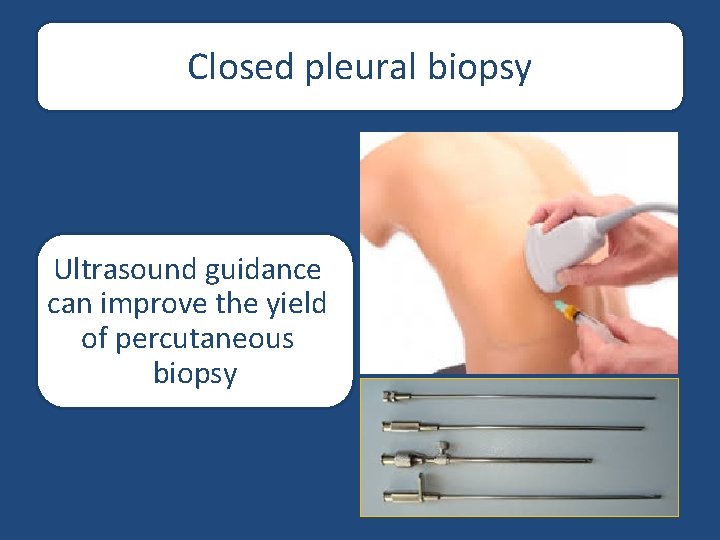 Closed pleural biopsy Ultrasound guidance can improve the yield of percutaneous biopsy 