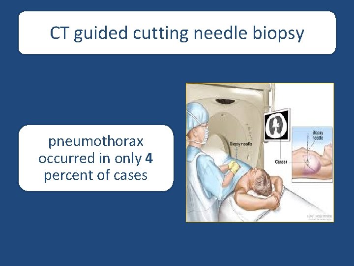 CT guided cutting needle biopsy pneumothorax occurred in only 4 percent of cases 