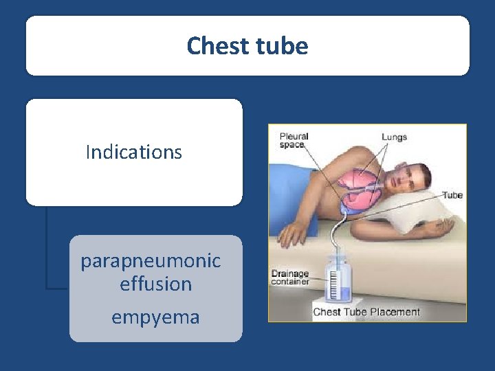 Chest tube Indications parapneumonic effusion empyema 