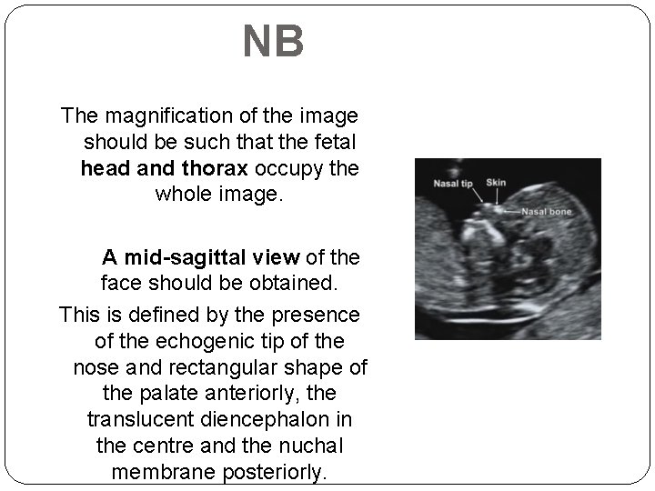 NB The magnification of the image should be such that the fetal head and