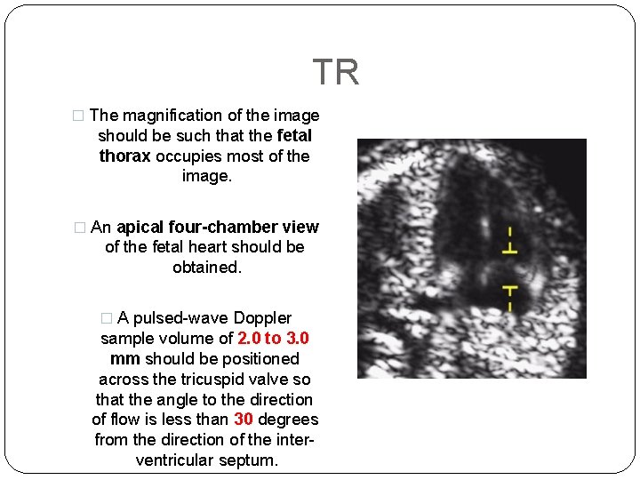 TR � The magnification of the image should be such that the fetal thorax