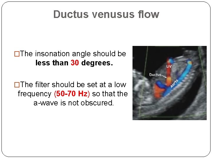 Ductus venusus flow �The insonation angle should be less than 30 degrees. �The filter