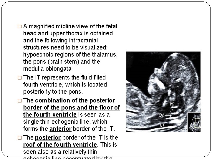 � A magnified midline view of the fetal head and upper thorax is obtained