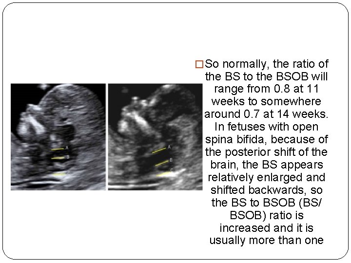 � So normally, the ratio of the BS to the BSOB will range from