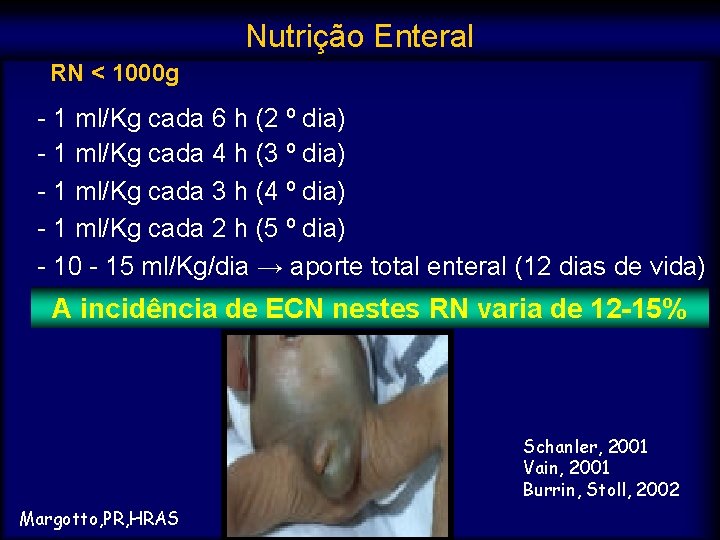 Nutrição Enteral RN < 1000 g - 1 ml/Kg cada 6 h (2 º