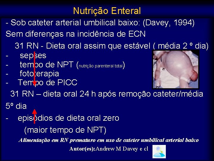 Nutrição Enteral - Sob cateter arterial umbilical baixo: (Davey, 1994) Sem diferenças na incidência