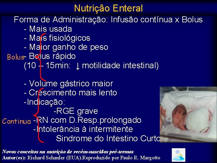 Nutrição Enteral Forma de Administração: Infusão contínua x Bolus - Mais usada - Mais