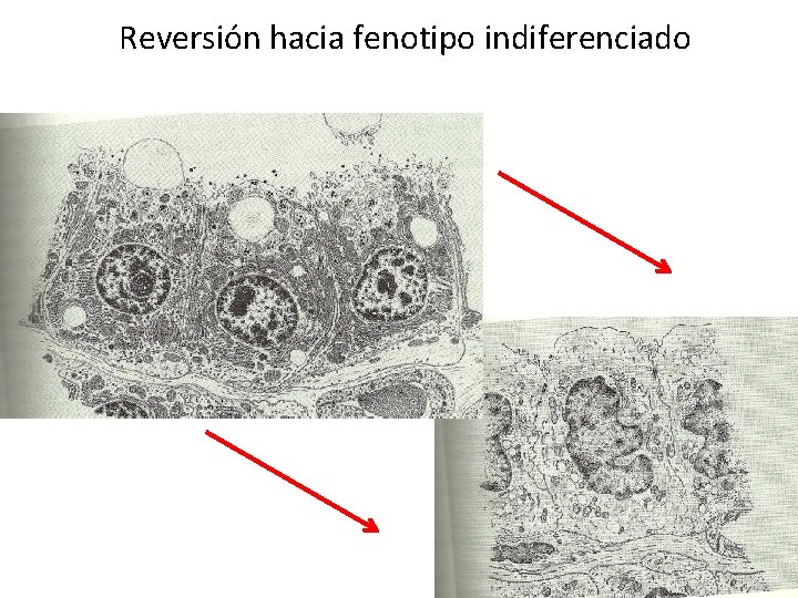 Reversión hacia fenotipo indiferenciado 
