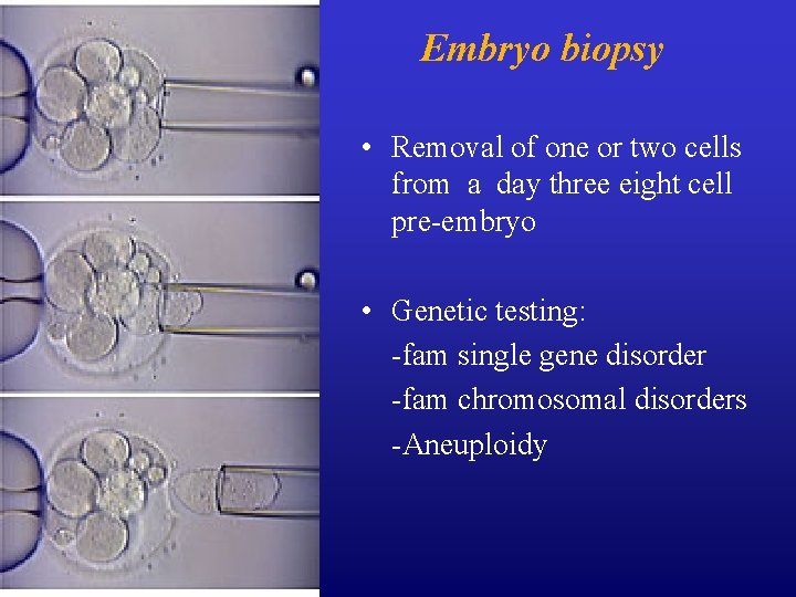 Embryo biopsy • Removal of one or two cells from a day three eight