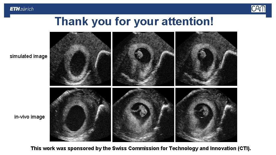 Thank you for your attention! simulated image in-vivo image This work was sponsored by