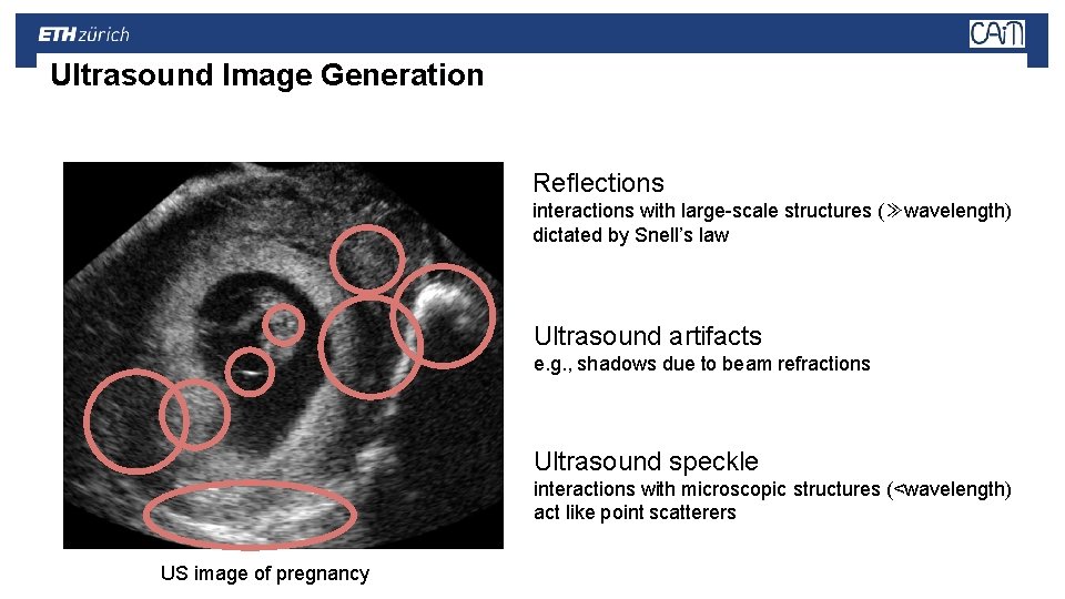 Ultrasound Image Generation Reflections interactions with large-scale structures (≫wavelength) dictated by Snell’s law Ultrasound