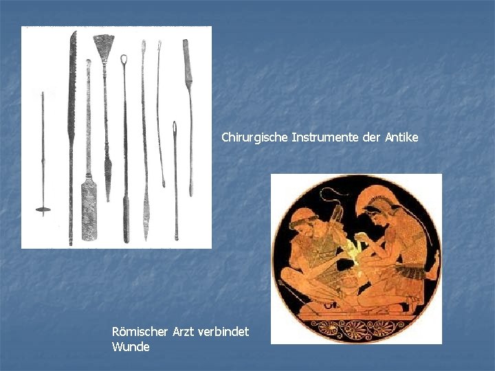 Chirurgische Instrumente der Antike Römischer Arzt verbindet Wunde 