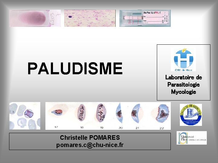  PALUDISME Christelle POMARES pomares. c@chu-nice. fr Laboratoire de Parasitologie Mycologie 