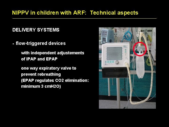 NIPPV in children with ARF: Technical aspects DELIVERY SYSTEMS - flow-triggered devices with independent NIPPV in children with ARF: Technical aspects DELIVERY SYSTEMS - flow-triggered devices with independent