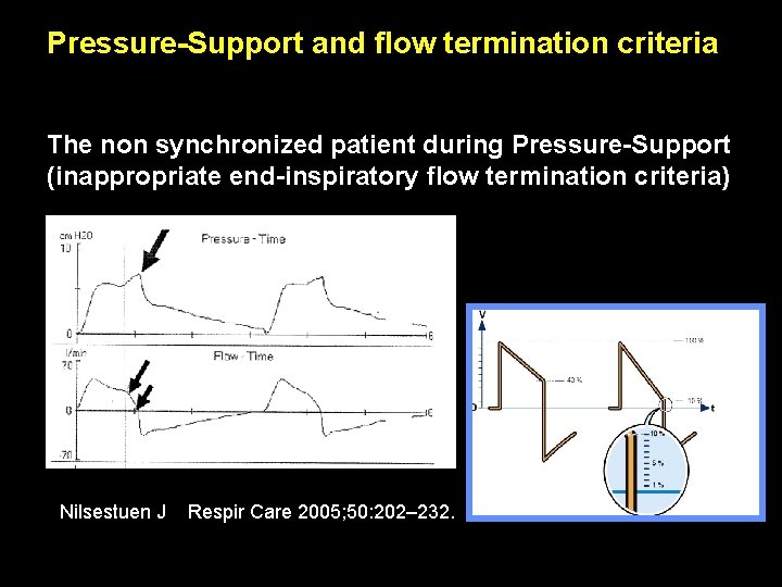 Pressure-Support and flow termination criteria The non synchronized patient during Pressure-Support (inappropriate end-inspiratory flow Pressure-Support and flow termination criteria The non synchronized patient during Pressure-Support (inappropriate end-inspiratory flow