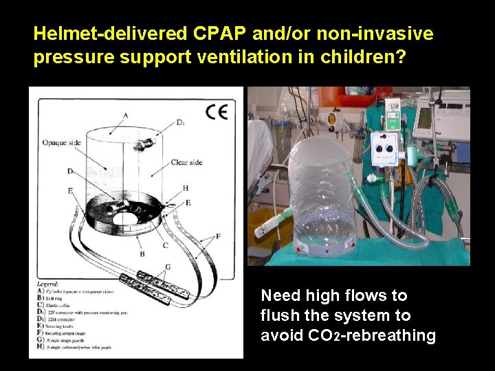 Helmet-delivered CPAP and/or non-invasive pressure support ventilation in children? Need high flows to flush Helmet-delivered CPAP and/or non-invasive pressure support ventilation in children? Need high flows to flush