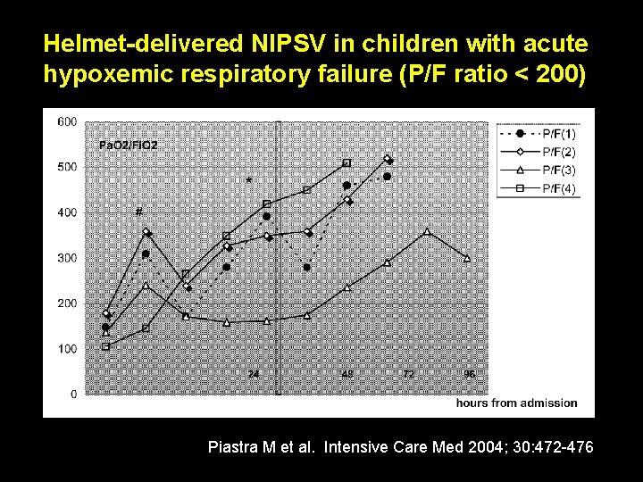 Helmet-delivered NIPSV in children with acute hypoxemic respiratory failure (P/F ratio < 200) Piastra Helmet-delivered NIPSV in children with acute hypoxemic respiratory failure (P/F ratio < 200) Piastra